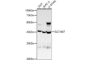 Western blot analysis of extracts of various cell lines, using (ABIN6134859, ABIN6147861, ABIN6147862 and ABIN6215999) at 1:1000 dilution. (SLC16A7 抗体  (C-Term))