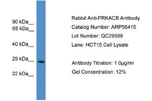 WB Suggested Anti-PRKACB  Antibody Titration: 0.