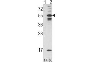 Western Blotting (WB) image for anti-Calcium/calmodulin-Dependent Protein Kinase II alpha (CAMK2A) antibody (ABIN3003199) (CAMK2A 抗体)