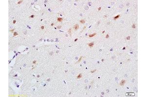 Formalin-fixed and paraffin embedded rat brain labeled with Anti-5-HT Polyclonal Antibody, Unconjugated  at 1:200 followed by conjugation to the secondary antibody and DAB staining. (Serotonin 抗体)