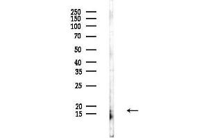 anti-Interleukin 1 eta (FIL1h) (C-Term) antibody