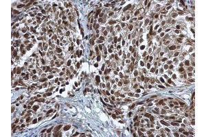 Immunohistochemistry (IHC) image for anti-Proliferating Cell Nuclear Antigen (PCNA) antibody (ABIN2854788)