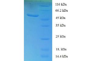 SDS-PAGE (SDS) image for Sclerostin Domain Containing 1 (SOSTDC1) (AA 24-206) protein (GST tag) (ABIN5710404)