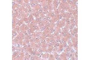 Immunohistochemistry (IHC) image for anti-Nsa1p (NSA1) (C-Term) antibody (ABIN1030550) (Nsa1p (NSA1) (C-Term) 抗体)