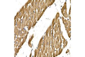 Immunohistochemistry of paraffin-embedded rat heart using PDGFB Rabbit pAb (ABIN3021688, ABIN3021689, ABIN3021690 and ABIN6215511) at dilution of 1:150 (40x lens). (PDGFB 抗体  (AA 20-241))