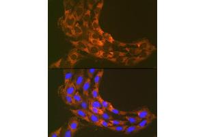 Immunofluorescence analysis of C6 cells using RPS20 Rabbit mAb (ABIN7270017) at dilution of 1:100 (40x lens).