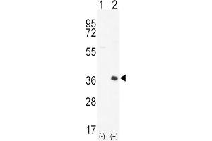 Western Blotting (WB) image for anti-Proto-Oncogene Pim-2 (Serine Threonine Kinase) (PIM2) antibody (ABIN3003584) (PIM2 抗体)