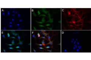 Immunofluorescence (IF) image for anti-Cytochrome P450, Family 1, Subfamily A, Polypeptide 1 (CYP1A1) antibody (ABIN6657370)