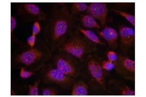 Image no. 1 for anti-B-Cell CLL/lymphoma 2 (BCL2) (Ser70) antibody (ABIN197204) (Bcl-2 抗体  (Ser70))