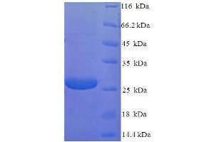 SDS-PAGE (SDS) image for Retinoschisin 1 (RS1) (AA 24-224) protein (His tag) (ABIN5710286)