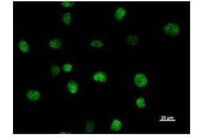 Immunostaining analysis in HeLa cells. (SATB2 抗体)