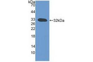 Western blot analysis of recombinant Mouse LTb. (LTB 抗体  (AA 58-304))