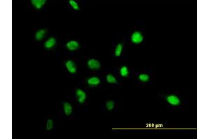 Immunofluorescence of monoclonal antibody to NPM1 on HeLa cell. (NPM1 抗体  (AA 1-294))