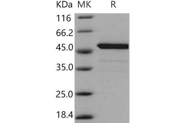 BID Protein (GST tag,His tag)