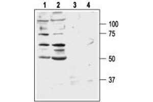 Western blot analysis of DU 145 (lanes 1 and 3) and PC-3 (lanes 2 and 4) human prostate carcinoma cell lines: - 1,2. (GRPR 抗体  (3rd Extracellular Loop))