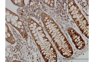 Immunostaining (ISt) image for anti-Deoxyuridine Triphosphatase (DUT) (AA 68-164) antibody (ABIN560672)