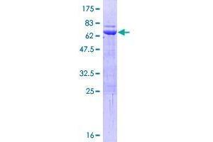 TRIM63 Protein (AA 1-353) (GST tag)