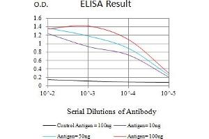 Black line: Control Antigen (100 ng),Purple line: Antigen (10 ng), Blue line: Antigen (50 ng), Red line:Antigen (100 ng) (S100B 抗体  (AA 1-92))
