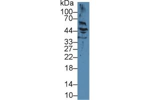 Western Blot; Sample: Human Hela cell lysate; Primary Ab: 2µg/ml Mouse Anti-Human KRT17 Antibody Second Ab: 0. (KRT17 抗体)