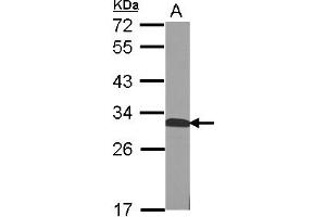 Image no. 1 for anti-Quinoid Dihydropteridine Reductase (QDPR) (AA 1-244) antibody (ABIN1501905) (QDPR 抗体  (AA 1-244))