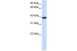 KLHDC8B antibody used at 1 ug/ml to detect target protein. (KLHDC8B 抗体  (Middle Region))