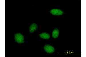 Immunofluorescence of purified MaxPab antibody to ZHX3 on HeLa cell. (ZHX3 抗体  (AA 1-969))