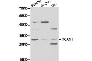 Western Blotting (WB) image for anti-Regulator of Calcineurin 1 (RCAN1) antibody (ABIN1876514) (RCAN1 抗体)