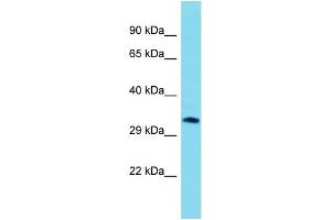 Host: Rabbit  Target Name: Aig1  Sample Tissue: Mouse Heart lysates  Antibody Dilution: 1. (AIG1 抗体  (Middle Region))