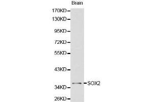 Western Blotting (WB) image for anti-SRY (Sex Determining Region Y)-Box 2 (SOX2) (AA 1-140) antibody (ABIN3021003)
