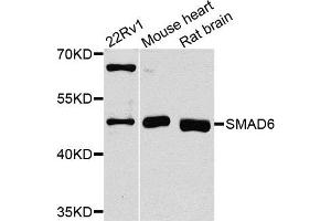 Western blot analysis of extracts of various cells, using SMAD6 antibody. (SMAD6 抗体)