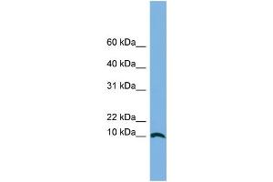 WB Suggested Anti-STRA13 Antibody Titration: 0. (STRA13 抗体  (Middle Region))