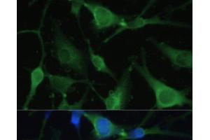 Immunofluorescence analysis of U-251 MG cells using FABP7 Polyclonal Antibody at dilution of 1:100. (FABP7 抗体)