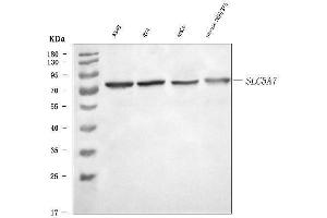 Western blot analysis of SLC5A7 using anti-SLC5A7 antibody (ABIN7601754).