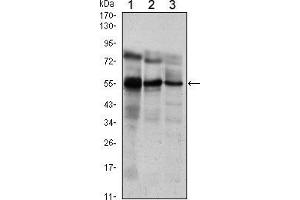 Western blot analysis using ETV5 mouse mAb against Jurkat (1), NIH/3T3 (2) and MCF-7 (3) cell lysate. (ETV5 抗体)