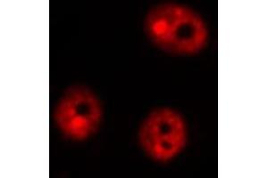 ABIN6267488 staining Hela by IF/ICC.