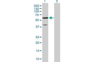 Western Blot analysis of RTN2 expression in transfected 293T cell line by RTN2 MaxPab polyclonal antibody. (Reticulon 2 抗体  (AA 1-472))