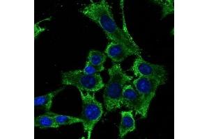 Immunofluorescence (IF) image for anti-Ribosomal Protein S6 (RPS6) (C-Term) antibody (ABIN1440052) (RPS6 抗体  (C-Term))