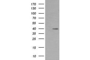 Image no. 2 for anti-Mitogen-Activated Protein Kinase Kinase 3 (MAP2K3) antibody (ABIN1499409) (MAP2K3 抗体)