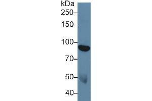Western blot analysis of Human Serum, using Human DDR1 Antibody (5 µg/ml) and HRP-conjugated Goat Anti-Rabbit antibody ( (DDR1 抗体  (AA 568-829))