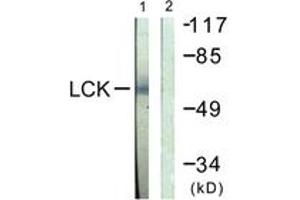 Western blot analysis of extracts from Jurkat cells, using Lck (Ab-505) Antibody. (LCK 抗体  (AA 460-509))