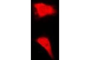 Immunofluorescent analysis of BORIS staining in MCF7 cells. (CTCFL 抗体)