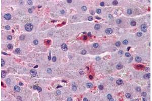 Human Liver: Formalin-Fixed, Paraffin-Embedded (FFPE) (Hepcidin 抗体  (AA 25-85))