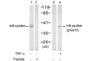 Image no. 2 for anti-Nuclear Factor of kappa Light Polypeptide Gene Enhancer in B-Cells Inhibitor, epsilon (NFKBIE) (Ser22) antibody (ABIN197570) (NFKBIE 抗体  (Ser22))