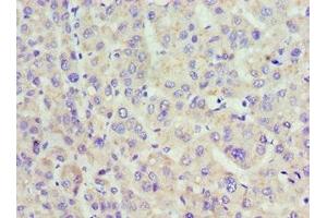 Immunohistochemistry of paraffin-embedded human placenta tissue using ABIN7158557 at dilution of 1:100 (ACP1 抗体  (AA 1-158))