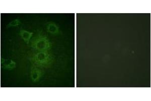 Immunofluorescence (IF) image for anti-BCL2-Interacting Killer (Apoptosis-Inducing) (BIK) (AA 18-67) antibody (ABIN2888586) (BIK 抗体  (AA 18-67))