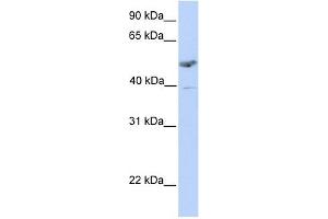 ST3GAL1 antibody used at 1 ug/ml to detect target protein. (ST3GAL1 抗体  (C-Term))