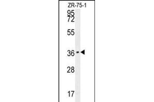 CLEC12A Antibody (Center) (ABIN653995 and ABIN2843932) western blot analysis in ZR-75-1 cell line lysates (35 μg/lane). (CLEC12A 抗体  (AA 178-206))