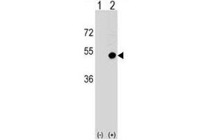 Western blot analysis of CD1d antibody and 293 cell lysate (2 ug/lane) either nontransfected (Lane 1) or transiently transfected (2) with the CD1D gene. (CD1d 抗体  (AA 177-206))