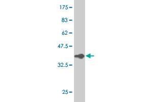Western Blot detection against Immunogen (37. (VAV1 抗体  (AA 681-790))