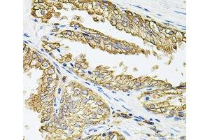 Immunohistochemistry of paraffin-embedded Human prostate using HLA-DQA1 Polyclonal Antibody at dilution of 1:100 (40x lens). (HLA-DQA1 抗体)